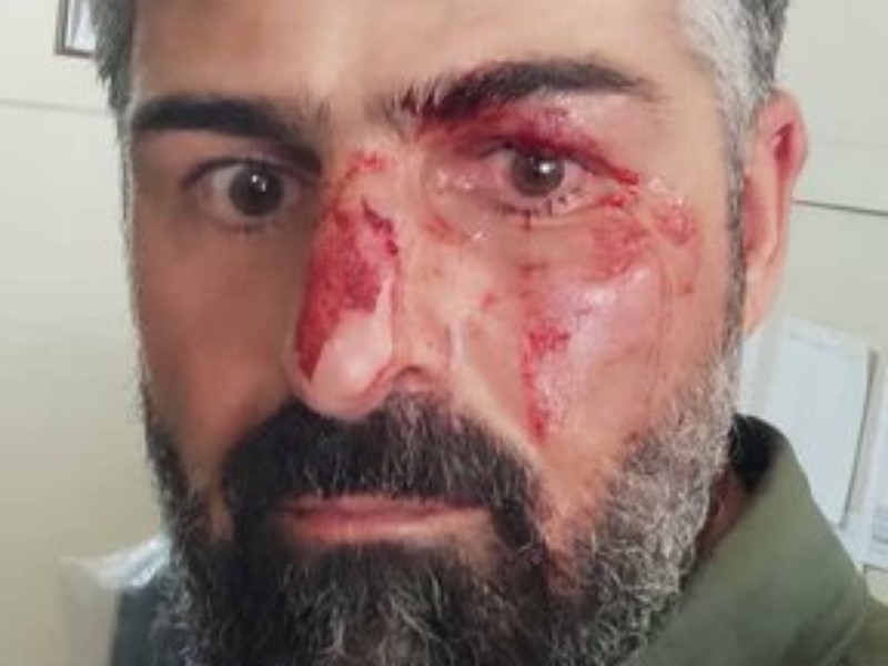 ضرب و شتم محیطبان سابق صحنه ای توسط شکارچیان غیرمجاز ضرب و شتم محیطبان سابق صحنه ای توسط شکارچیان غیرمجاز